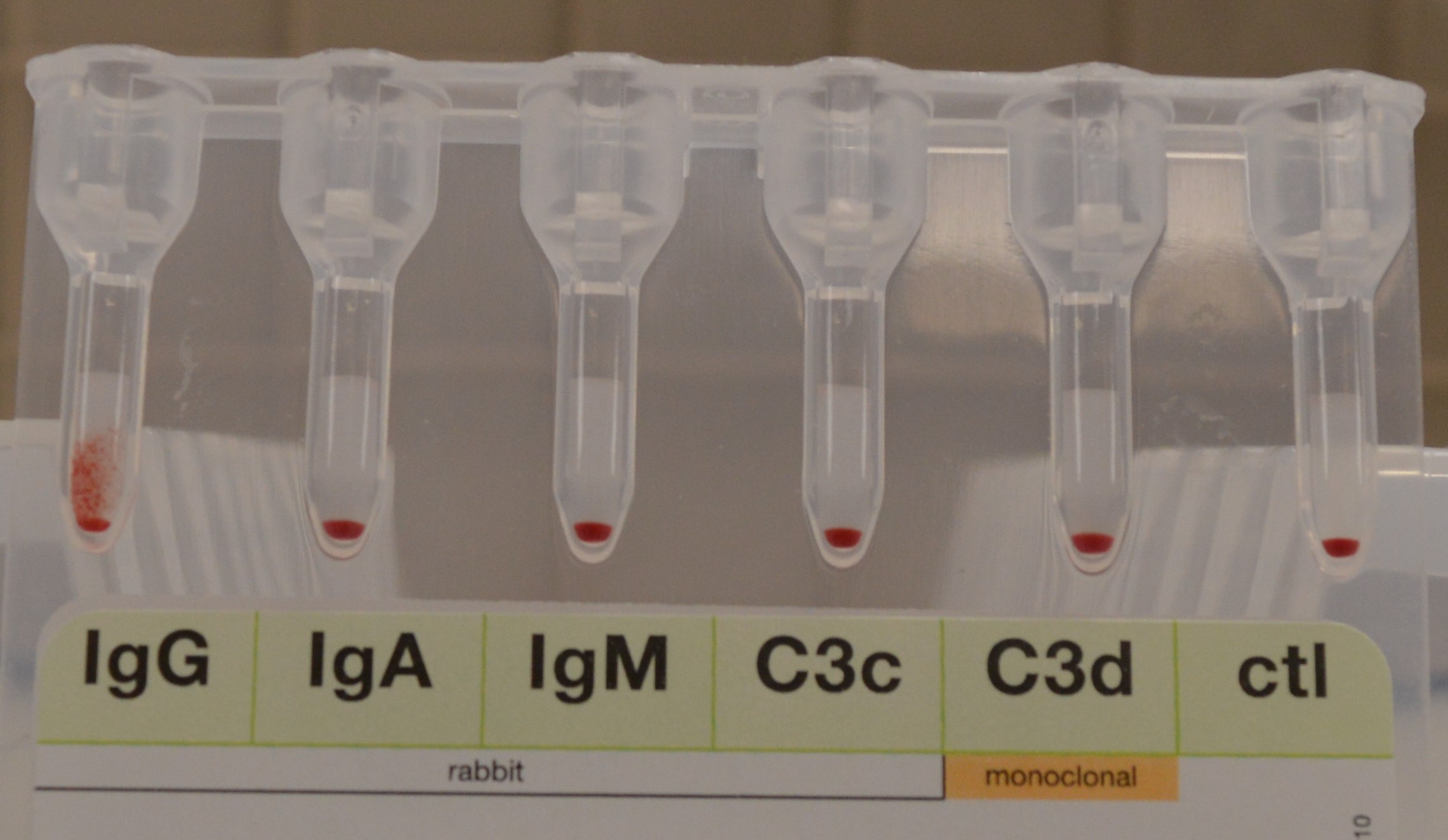 Bio-Rad Poly DAT gel card - Transfusion Services - PathLabTalk